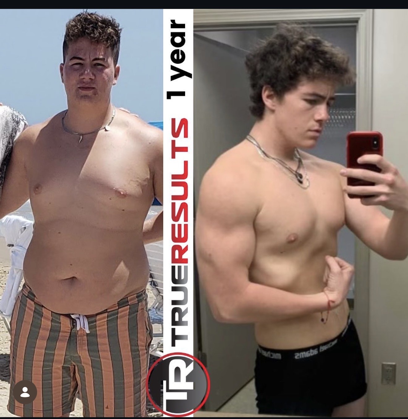 Luca's 1 year transformation with True Results